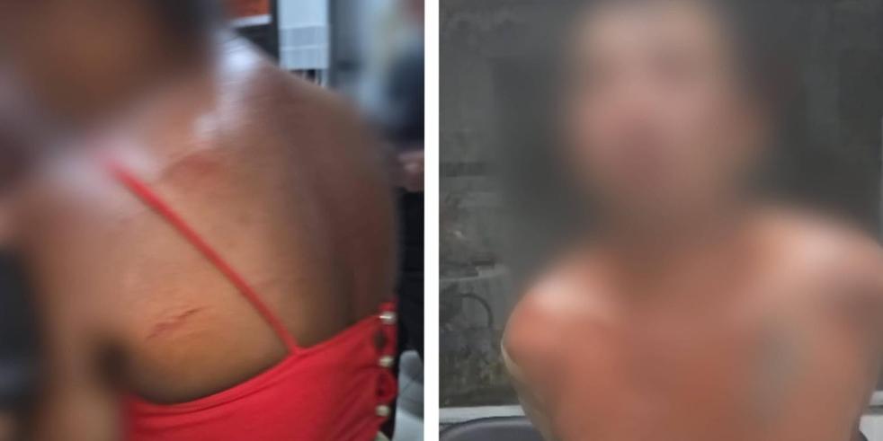 (O suspeito foi contido pelos policiais. A mulher apresentava hematomas nas costas e no braço direito, além de estar com a alça da blusa rasgada.)
