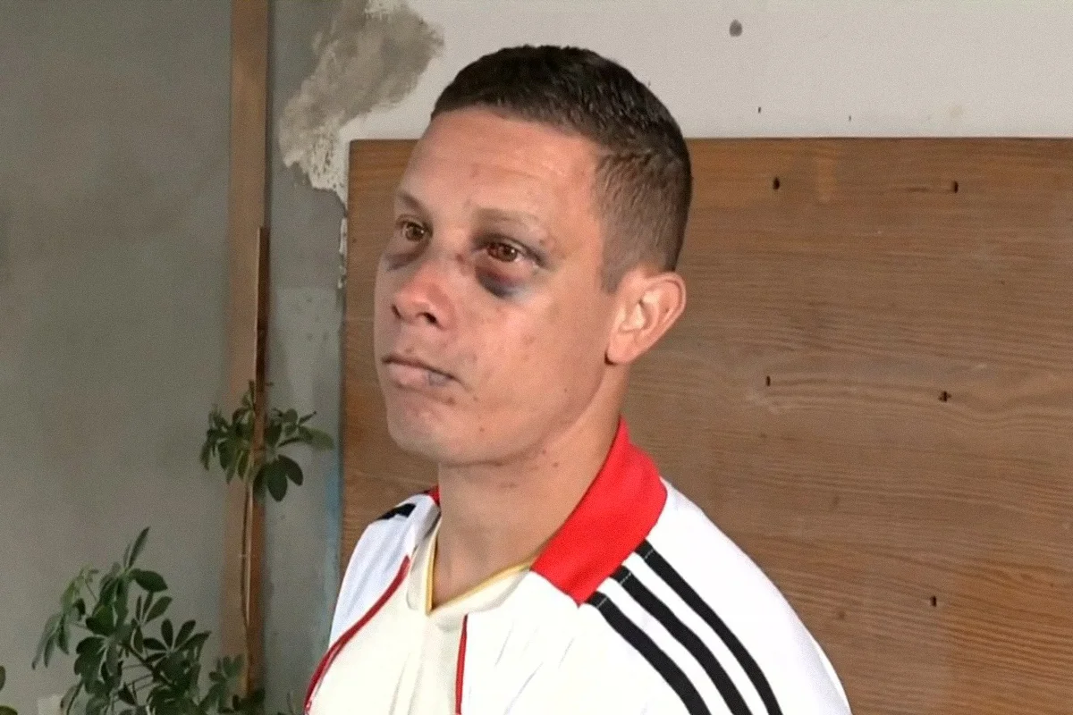 Vítima foi ameaçada com arma, agredida e queimada com cigarros antes de ser jogada de um carro em movimento em Realengo