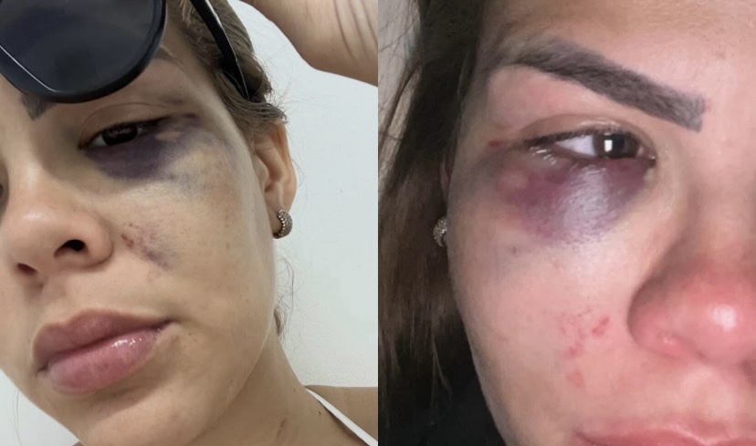 Jovem afirma ter sido vítima de violência física e psicológica durante viagem a Ponta de Pedras

