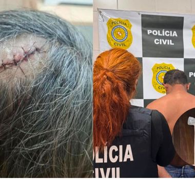 Imagem - Filho é preso após atacar a mãe com marreta em São Miguel do Guamá