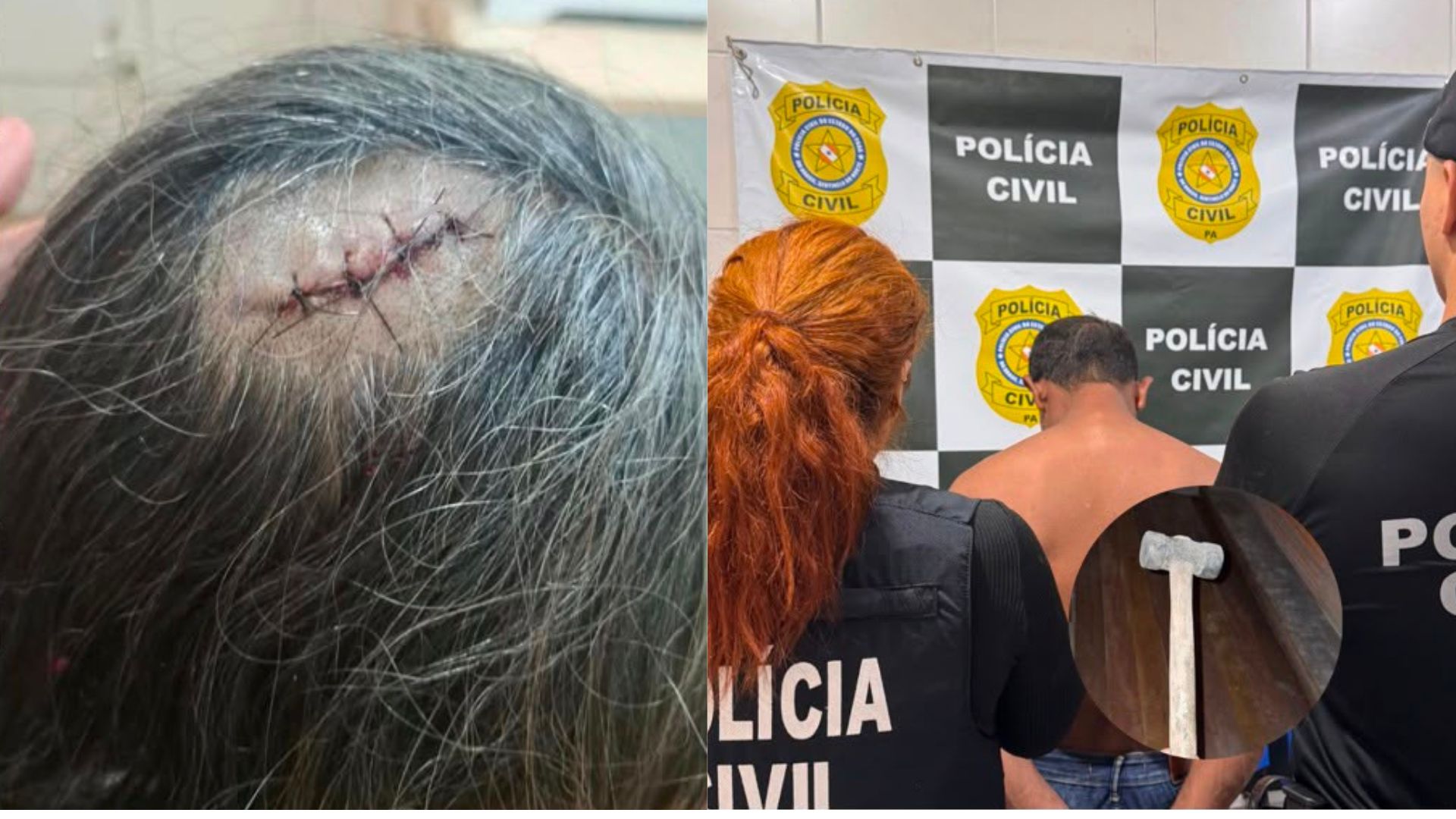 Filho é preso após atacar a mãe com marreta em São Miguel do Guamá