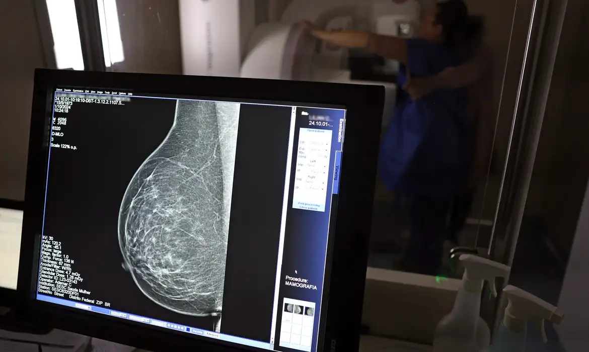 Planos de saúde no Brasil passam a ser obrigados a cobrir o exame de mamografia digital para todas as pessoas.