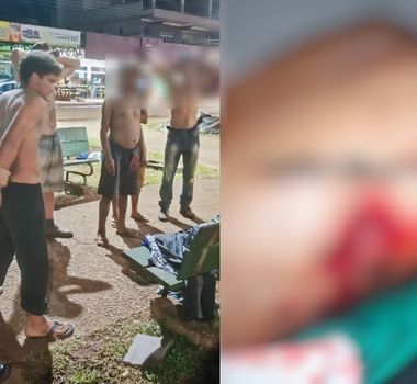 Imagem - Jovem leva 43 pontos após sobreviver a ataque com garrafa quebrada em Medicilândia