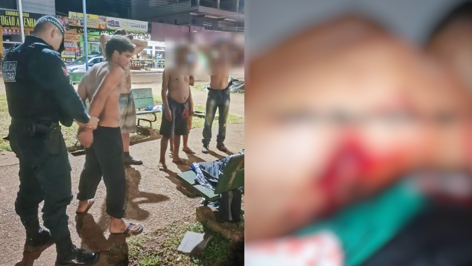 Imagem - Jovem leva 43 pontos após sobreviver a ataque com garrafa quebrada em Medicilândia