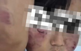 .