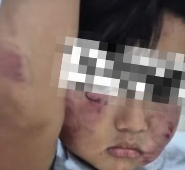 Imagem - Família denuncia agressões em criança de 2 anos dentro de creche particular em Belém