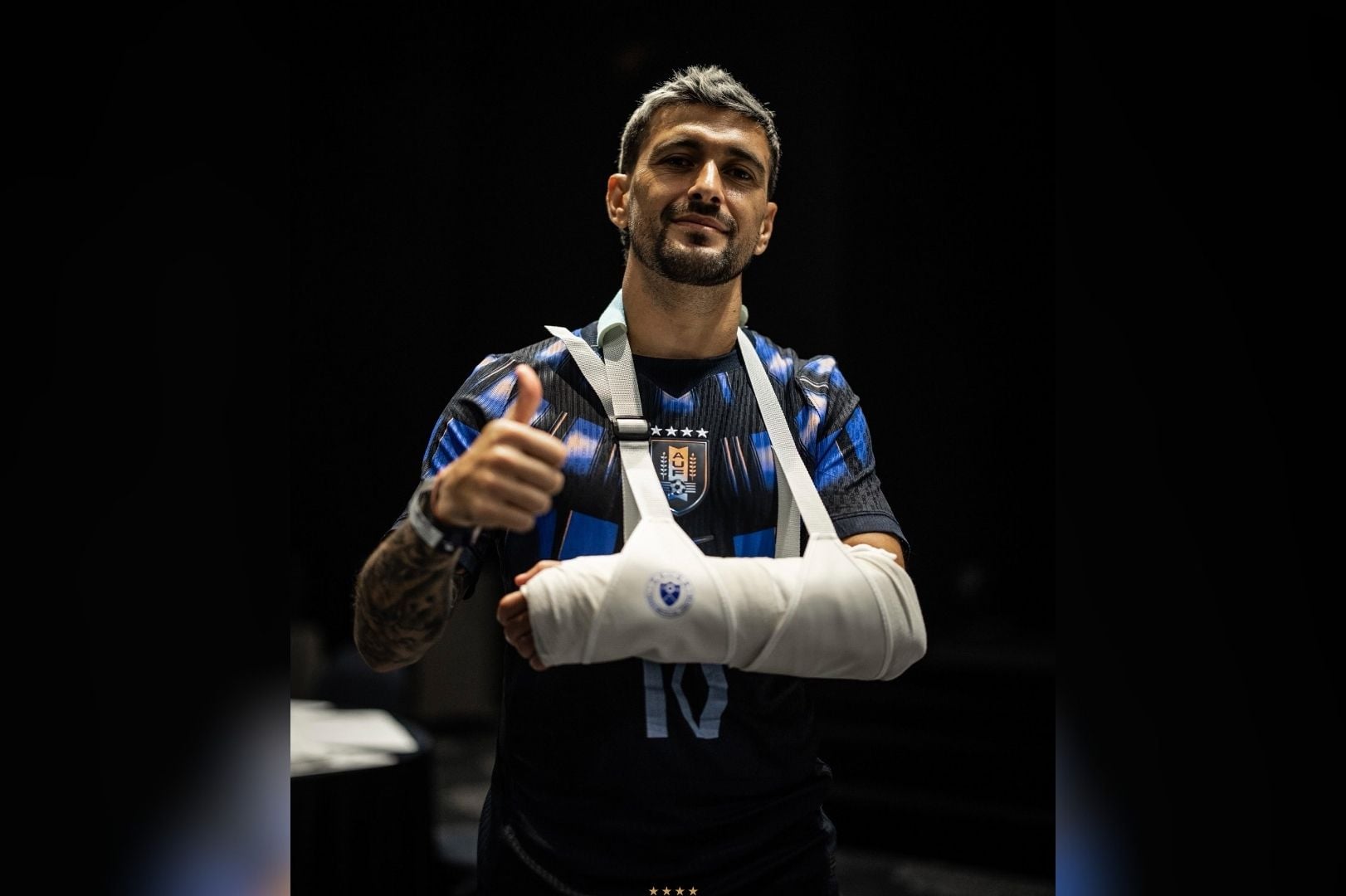 Meia lesionou o punho durante amistoso - 