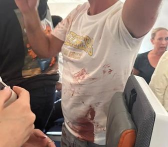 Imagem - Vídeo mostra confusão em avião que pilotos brigaram