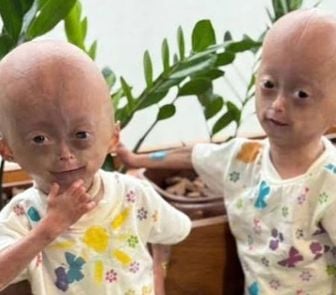 Imagem - Gesto de carinho marca despedida entre as gêmeas Elis e Eloá