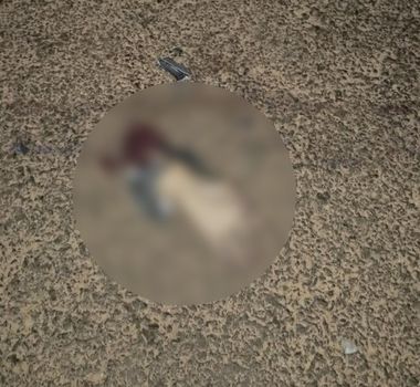 Imagem - Homem perde a mão em acidente grave no sudeste paraense