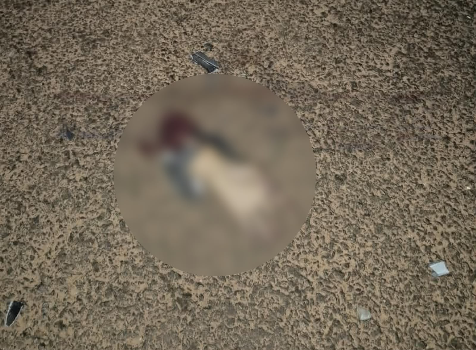 Homem perde a mão em acidente grave no sudeste paraense - 