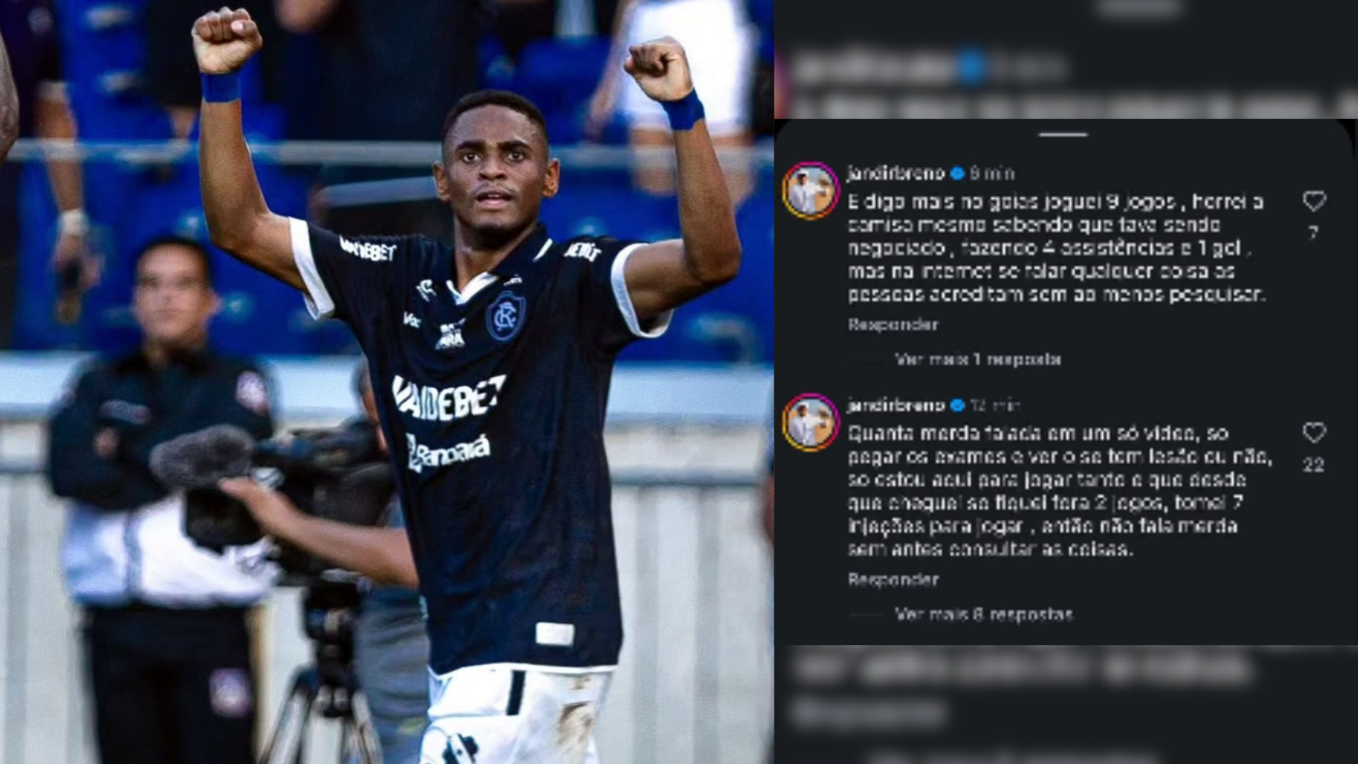Imagem - Jajá rebate críticas sobre lesão e revela ter tomado sete injeções para jogar pelo Remo