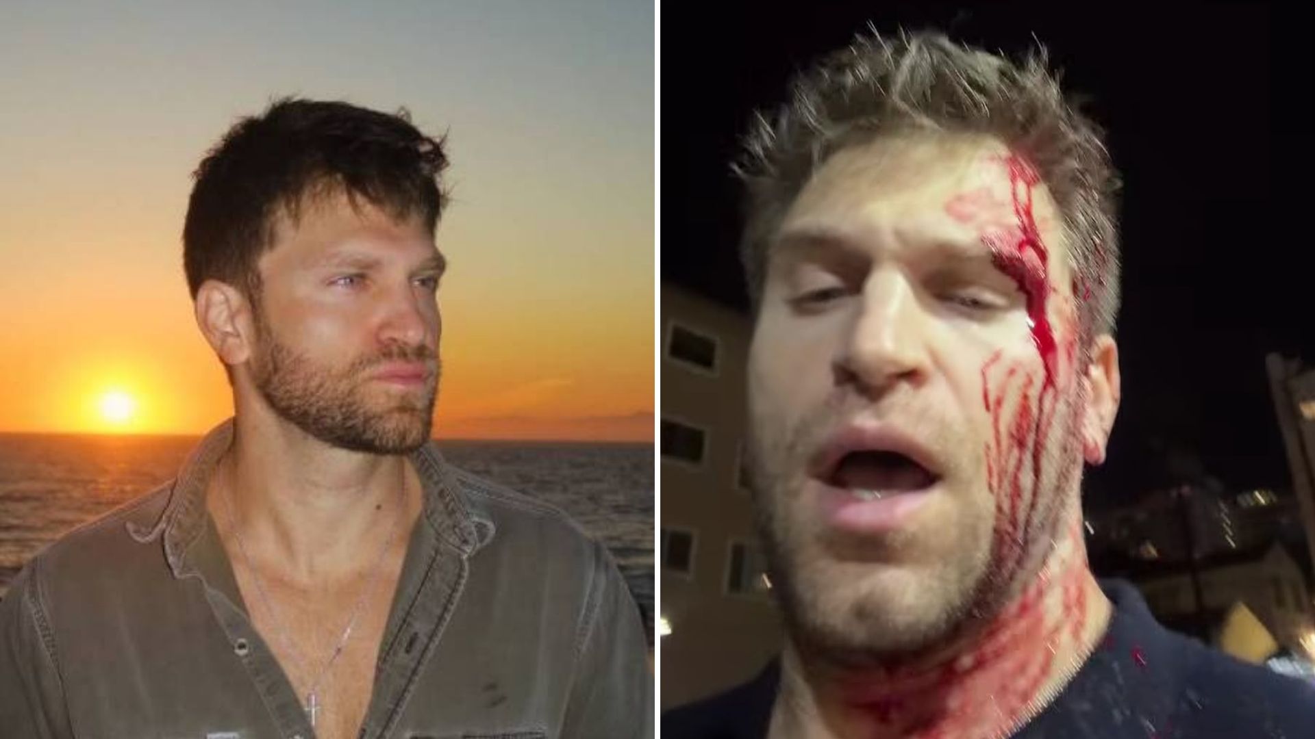 Ator Keegan Allen, reconhecido por interpretar o personagem Toby Cavanaugh na série dramática "Pretty Little Liars".