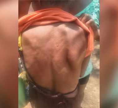 Imagem - Idosa de 77 anos é agredida pelo próprio filho em Belterra, no Pará