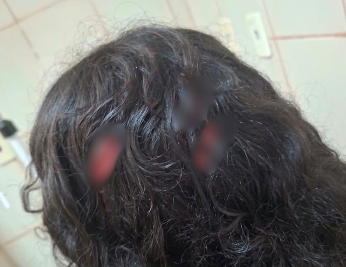 Adolescente é apreendido após esfaquear colega de 12 anos dentro da escola em Icoaraci