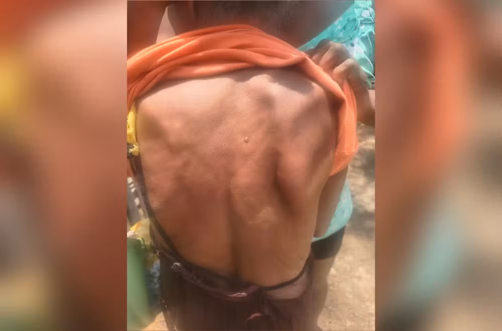Vítima foi encontrada com hematomas pelo corpo; suspeito foi detido após descumprir medida protetiva que determinava o afastamento da mãe.