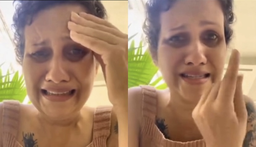 Em busca de uma solução, ela pede ajuda para conseguir o insumo e seguir com o tratamento.